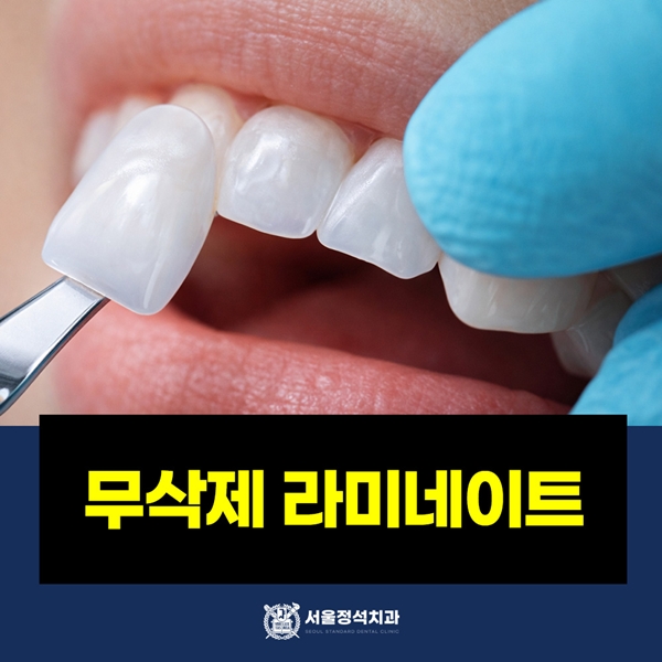 5. 무삭제 라미네이트.jpg